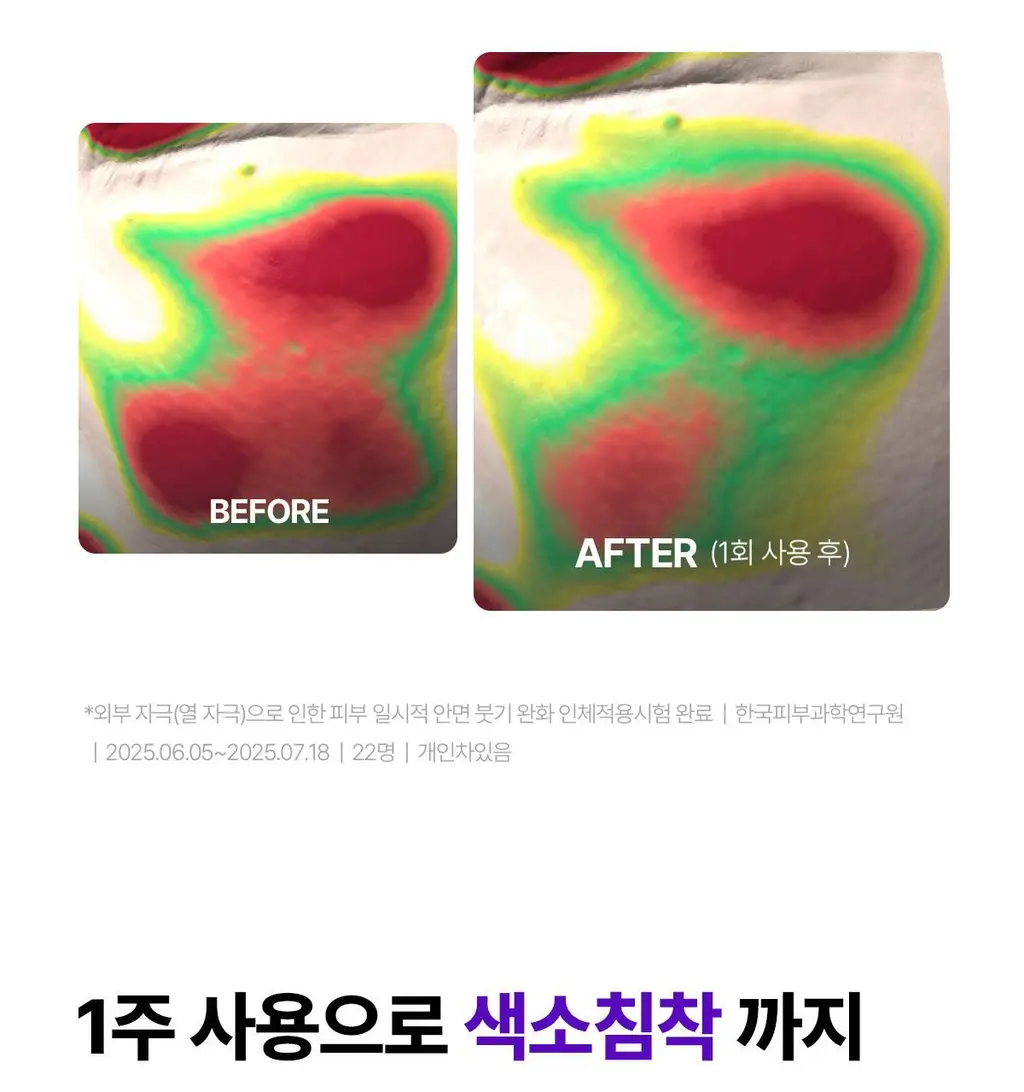 [1등 장벽PDRN/푸린백팩] 센텔리안24 마데카 크림 액티브 리뉴 PDRN 50ml 기획 (+15ml 포켓몬 에디션) 상세페이지 35